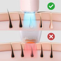 Ulike - Ice Cooling At-Home Hair Removal Device Air 3 - Pink - Alternate Views