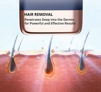 MLAY - T14 IPL Laser Hair Removal for Women/Men, 17J Energy, Ice-Cooling 37°F Painless Tech, Effe... - Back View